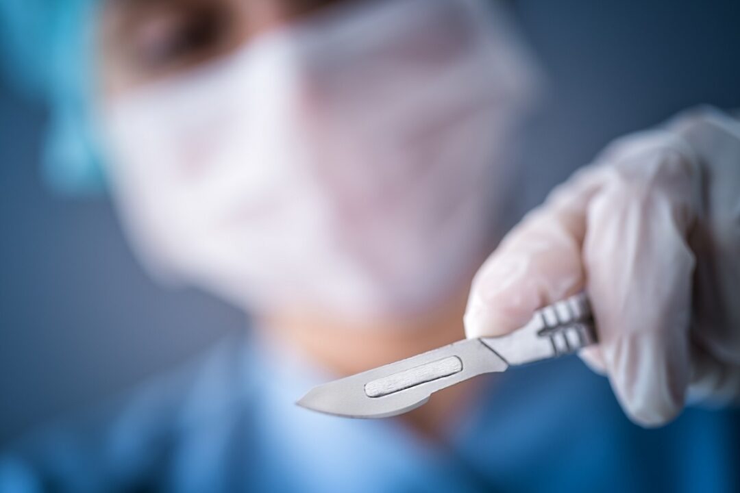 XActo Knives vs. Other Knives A Safety Comparison Guide